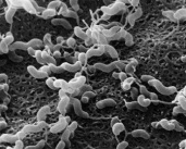 Picture: microscopic bacteria